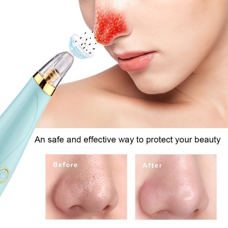 Blackhead Remover Pore Vacuum